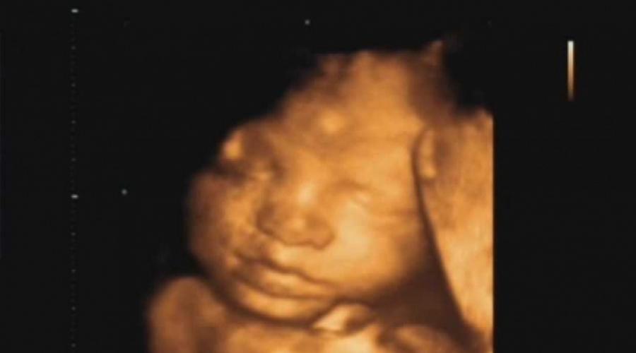 Bebeluș de 22 de săptămâni.  Totul despre a douăzeci și două de săptămâni de sarcină