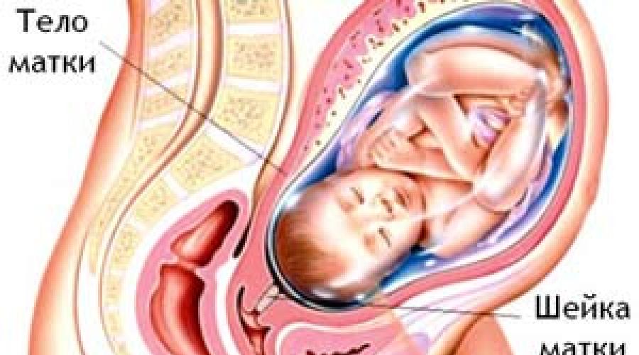 Comment savoir si l'utérus est en bon état ou non.  Comment comprendre que l'utérus est en bon état: une description des symptômes, des causes possibles, une consultation avec un gynécologue, un examen et un traitement si nécessaire