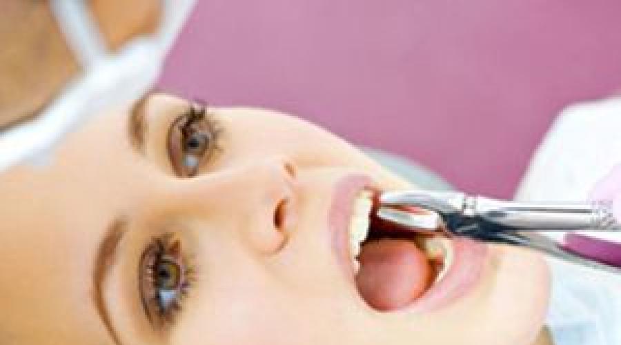 Überzählige Zähne bei Kindern.  Muss ich zusätzliche Zähne entfernen?  Entfernung abnormaler Zähne