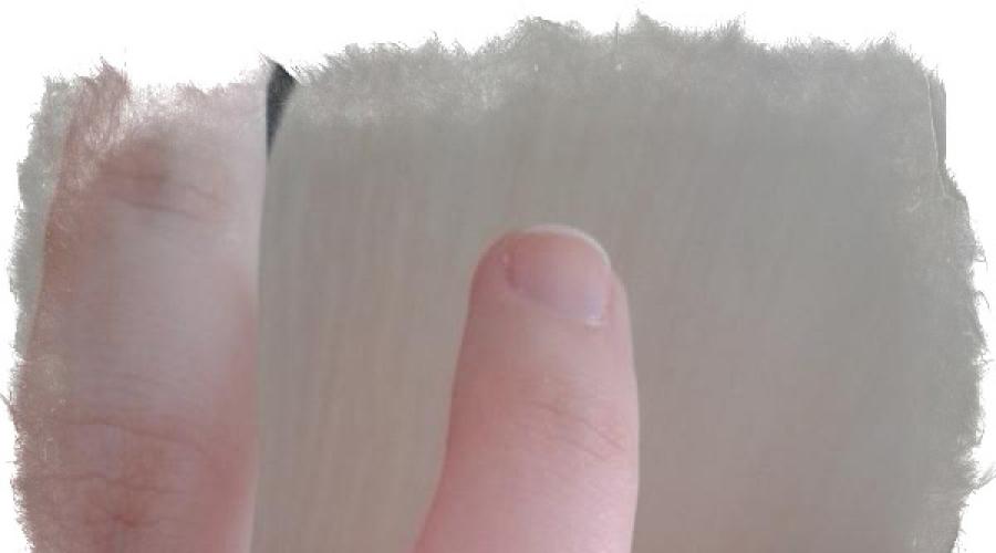 Aluniță pe degetul inelar al mâinii drepte sau stângi: sens.  Ce înseamnă alunițele de pe palme și degete